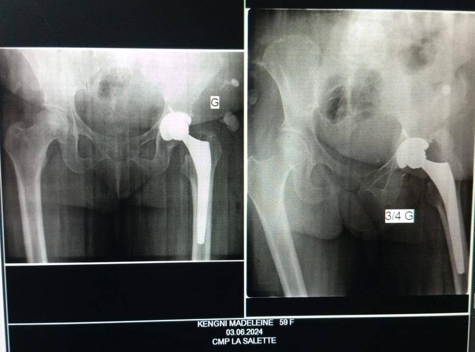 Radio après l'opération